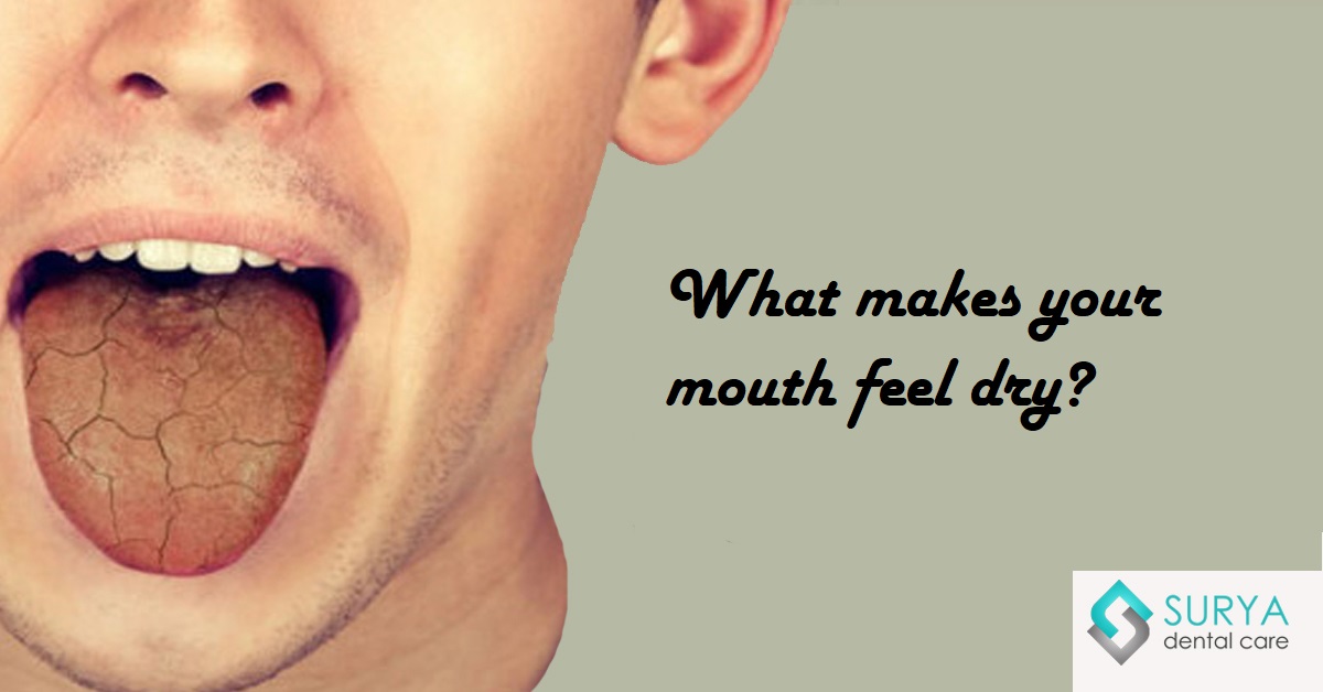 What makes your mouth feel dry?