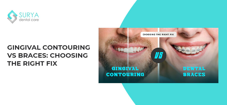 Gingival Contouring vs Braces: Choosing the Right Fix