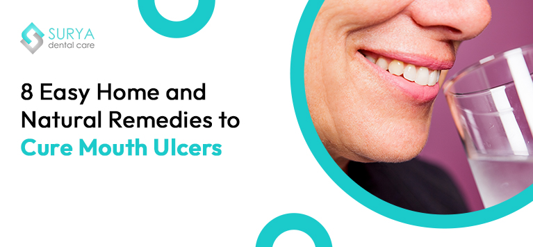 8 Simple Home Remedies for Quick Relief from Mouth Ulcers