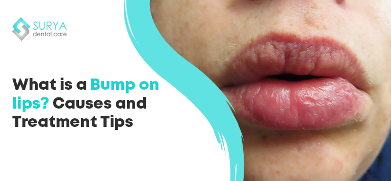 Pimple on the lips | Bump on the lips