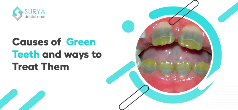 Green teeth