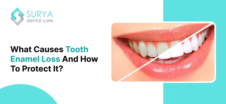 What Causes Tooth Enamel Loss and How to Protect It?