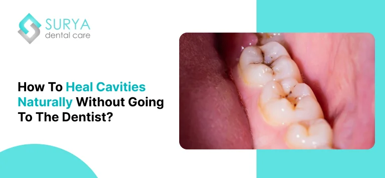 How to get rid of cavities naturally at home