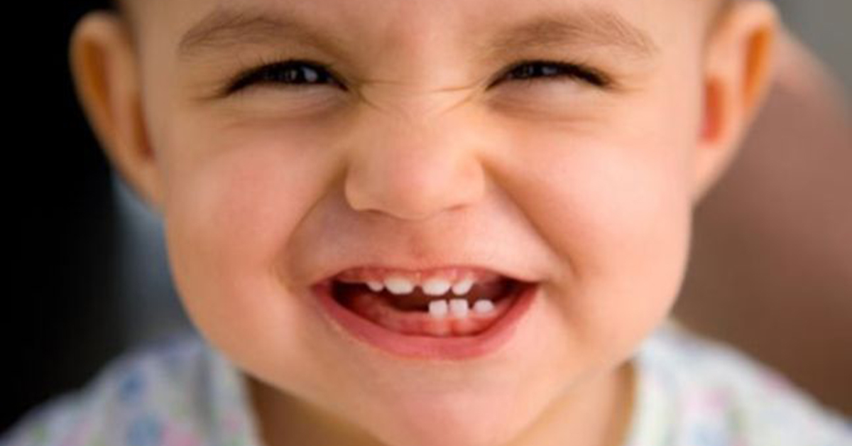Why should you care for your kid’s baby teeth?