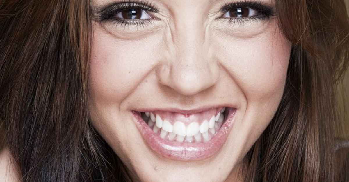 Different dental care solutions for gummy smile correction