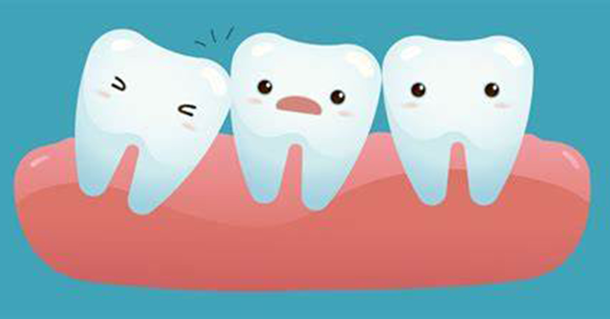 Warning signs you need to remove wisdom teeth