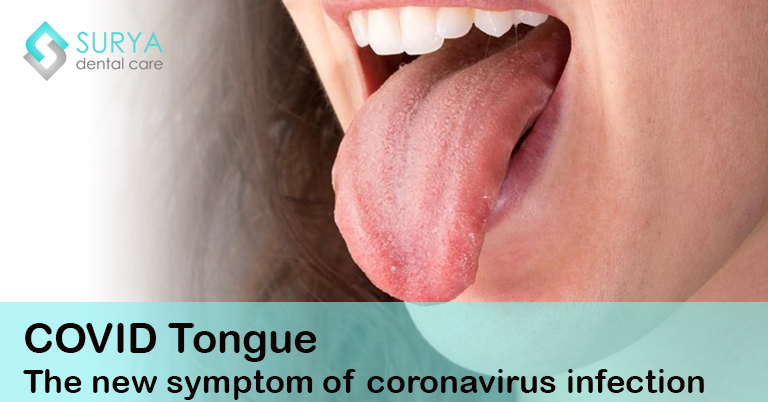 COVID Tongue – The new symptom of coronavirus infection