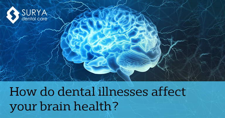 How do dental illnesses affect your brain health?