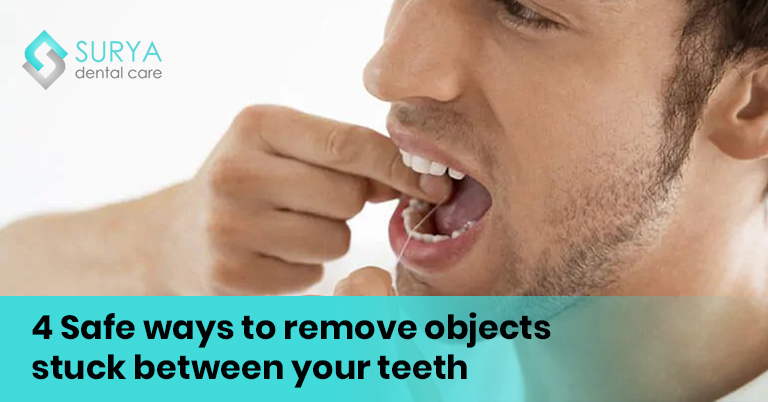 4 Safe ways to remove objects stuck between your teeth