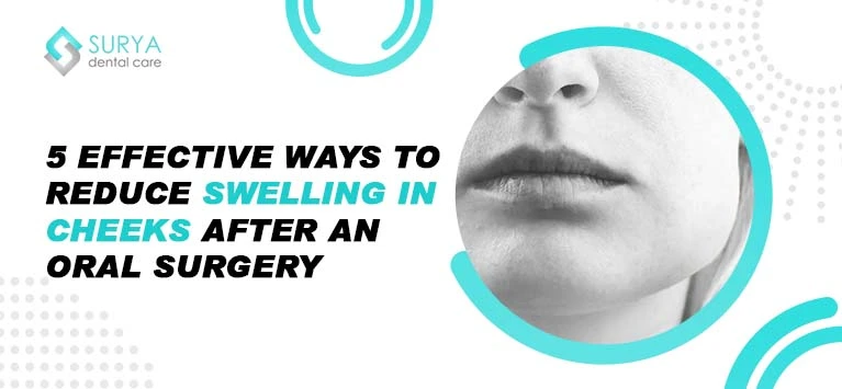 Swelling in cheek | Swelling on cheek