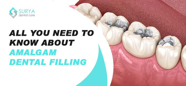 All You Need to Know about Amalgam Dental Filling