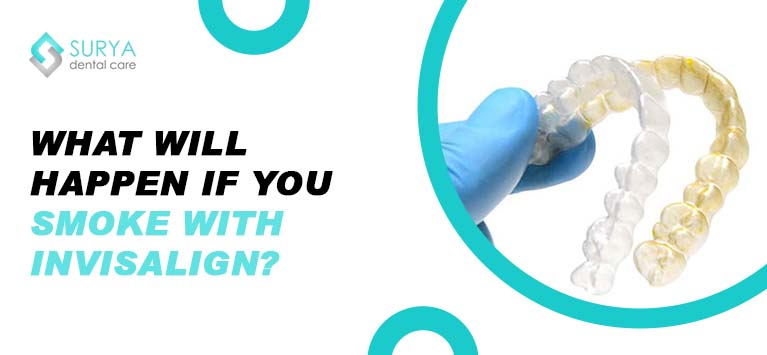 What will happen if you smoke with Invisalign?