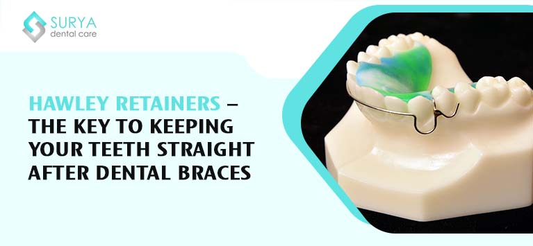 Hawley Retainers – The key to keeping your teeth straight after dental braces
