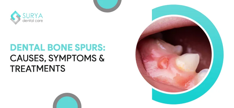gum bone spur pictures