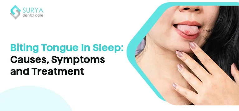 Biting Tongue In Sleep: Causes, Symptoms and Treatment