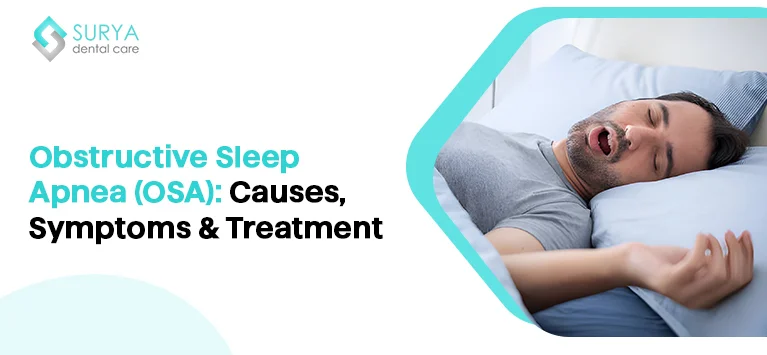 Obstructive Sleep Apnea (OSA): Causes, Symptoms & Treatment