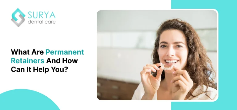 What are Permanent Retainers and How Can It Help You?