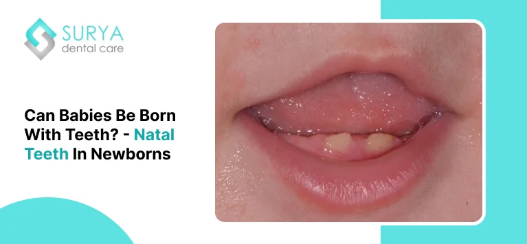 Can Babies Be Born With Teeth? – Natal Teeth In Newborns