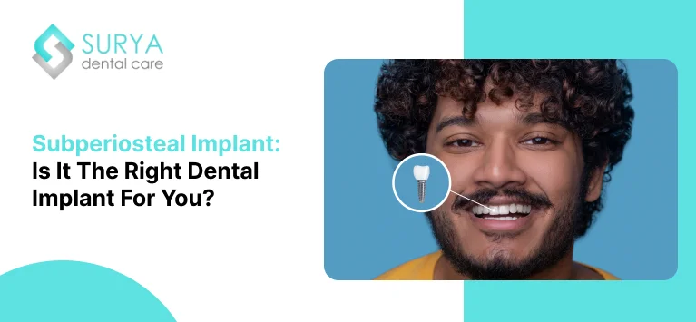 Subperiosteal Implant: Is It the Right Dental Implant for You?