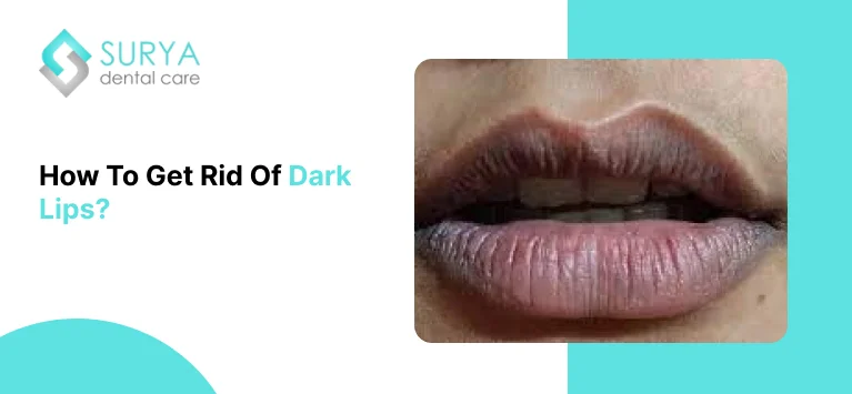 How To Get rid Of Dark Lips